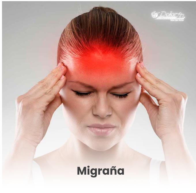 tratamiento migraña quiropractica